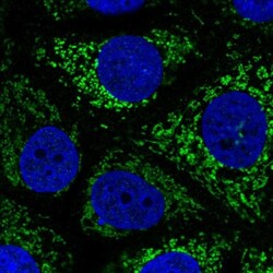 SDHA Antibody, Novus Biologicals 0.1mL; Unlabeled:Antibodies, Polyclonal